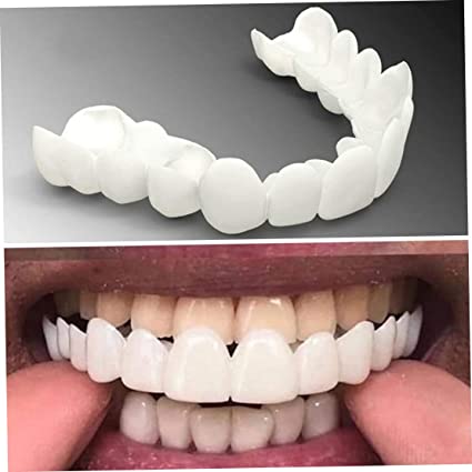 Facette dentaire : Souriez sans complexe