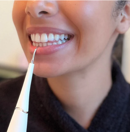 Détartreur électrique : Outil de blanchiment des dents